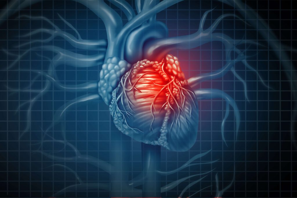 Cardiopulmonary Physical Therapy, Lets Move Physical Therapy - Las Vegas