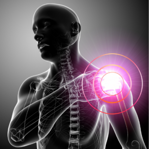Common Injuries that Lead to Shoulder Pain